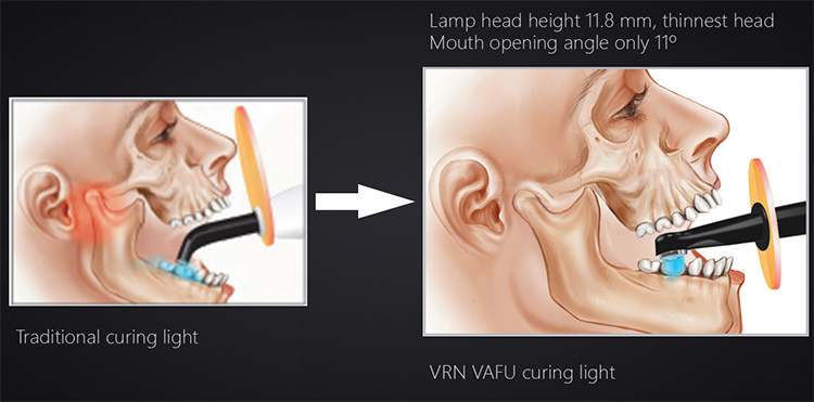 CL26 LED Curing Light